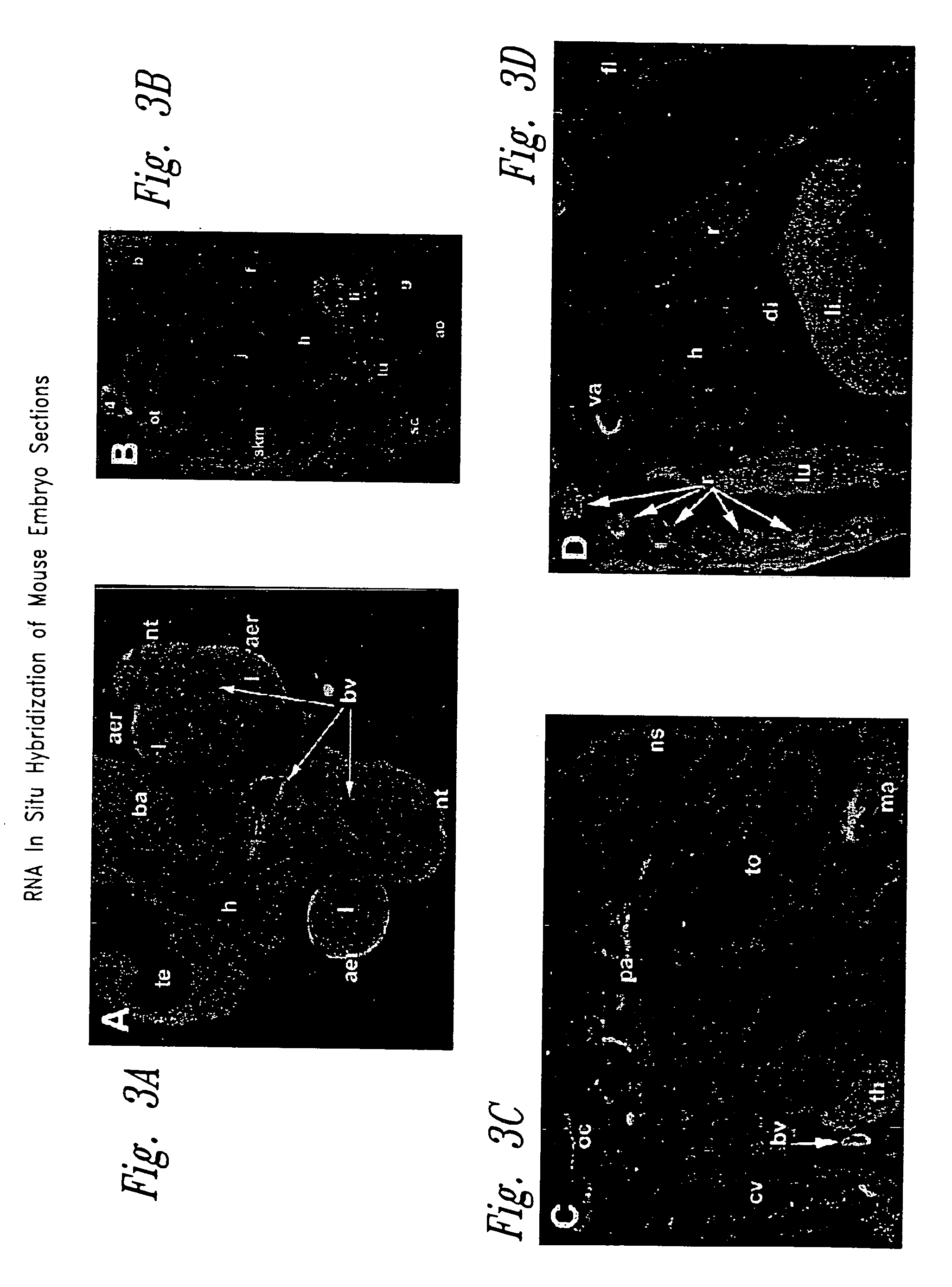 Compositions and methods for increasing bone mineralization