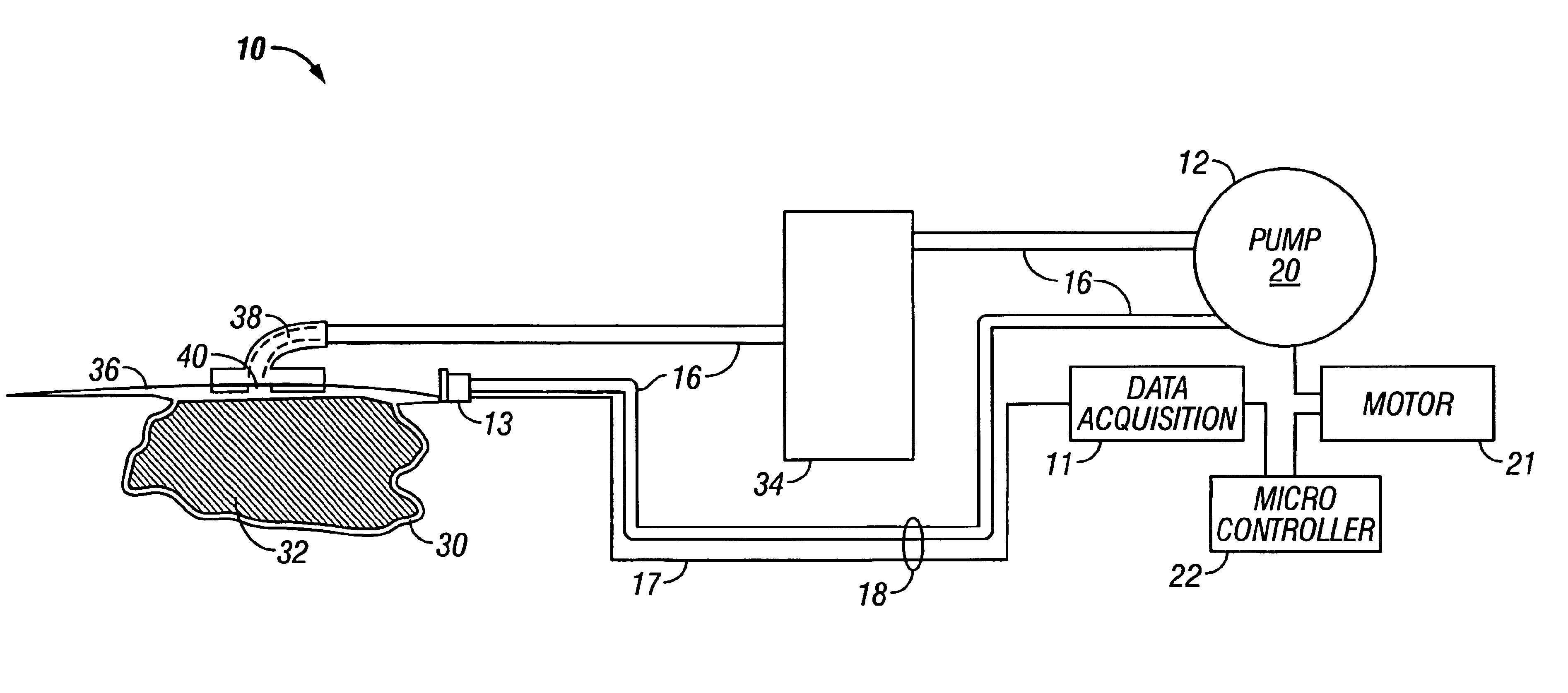 System for combined transcutaneous blood gas monitoring and vacuum assisted wound closure
