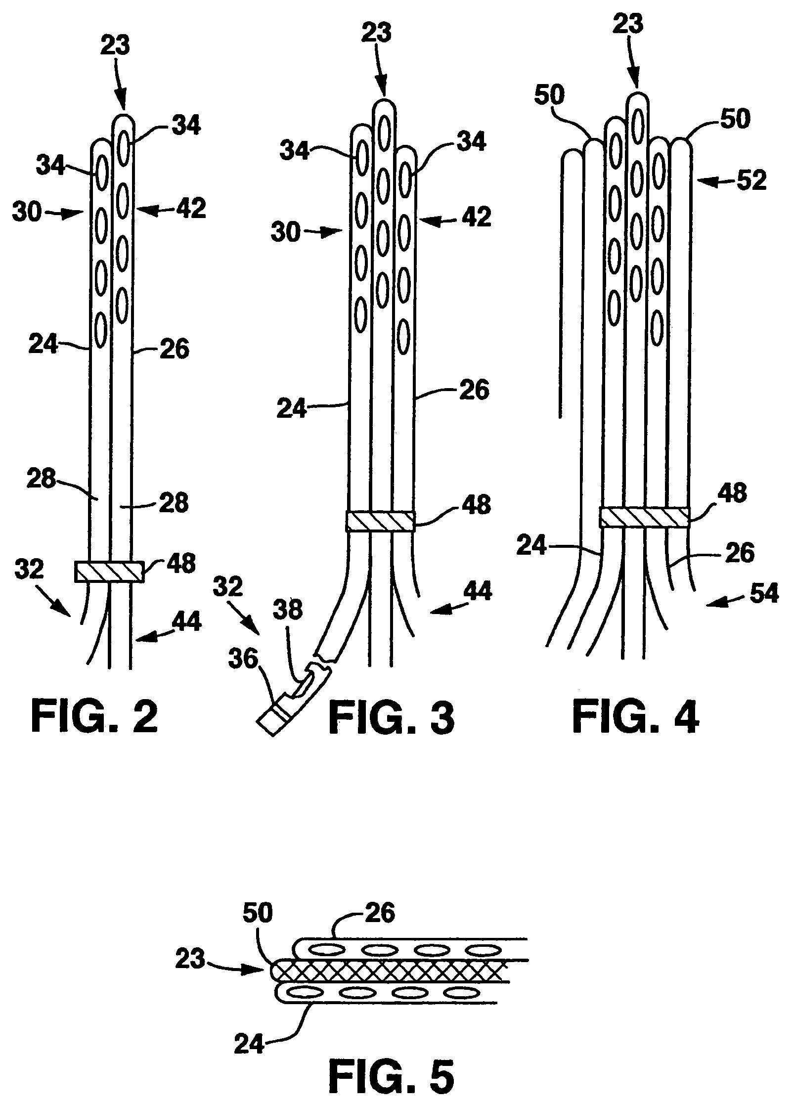 Method of use of implantable percutaneous stimulation lead