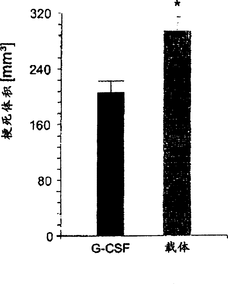 Use of G-CSF for the extension of the therapeutic time-window of thrombolytic stroke therapy