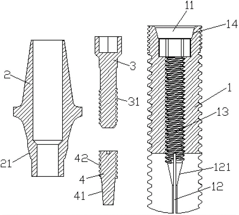 Two-section implant with spontaneous expansion function