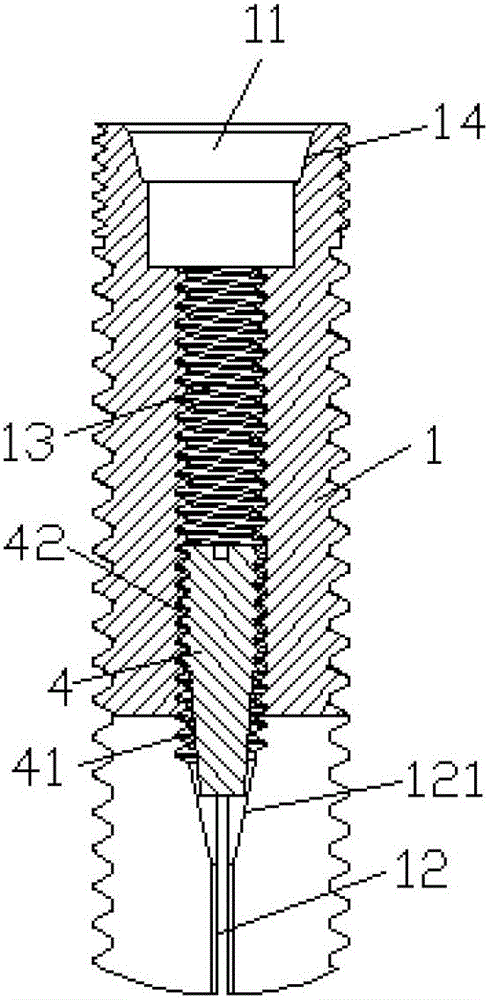 Two-section implant with spontaneous expansion function