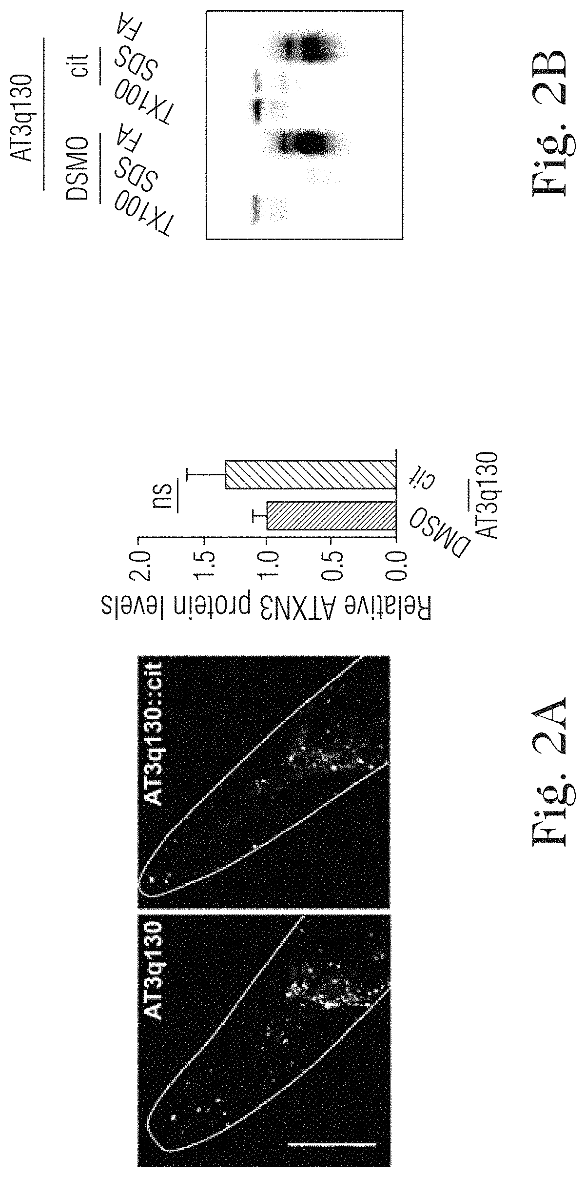 Citalopram or escitalopram for use in the treatment of neurodegenerative diseases