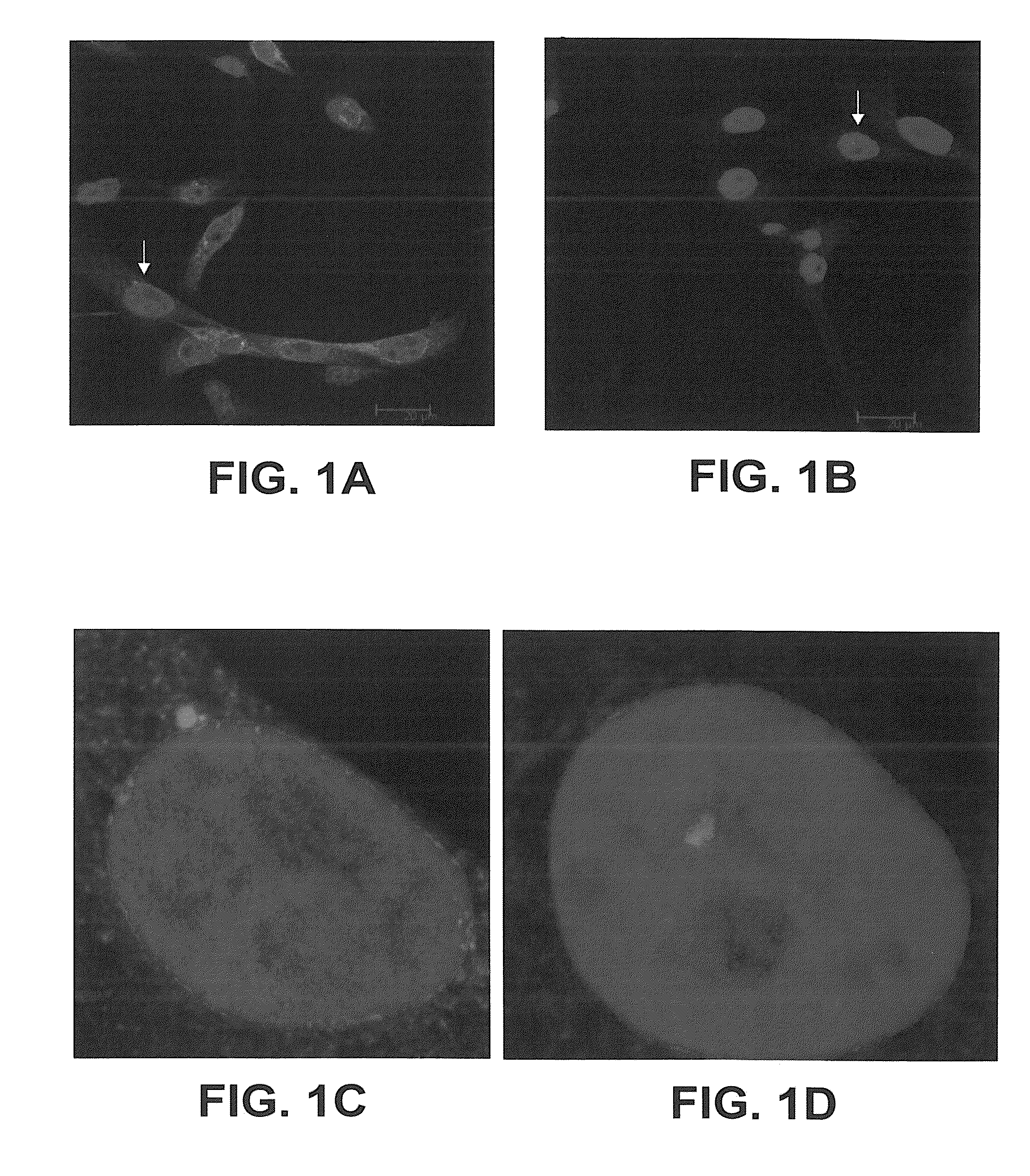 Methods and apparatus for diagnosis and/or prognosis of cancer
