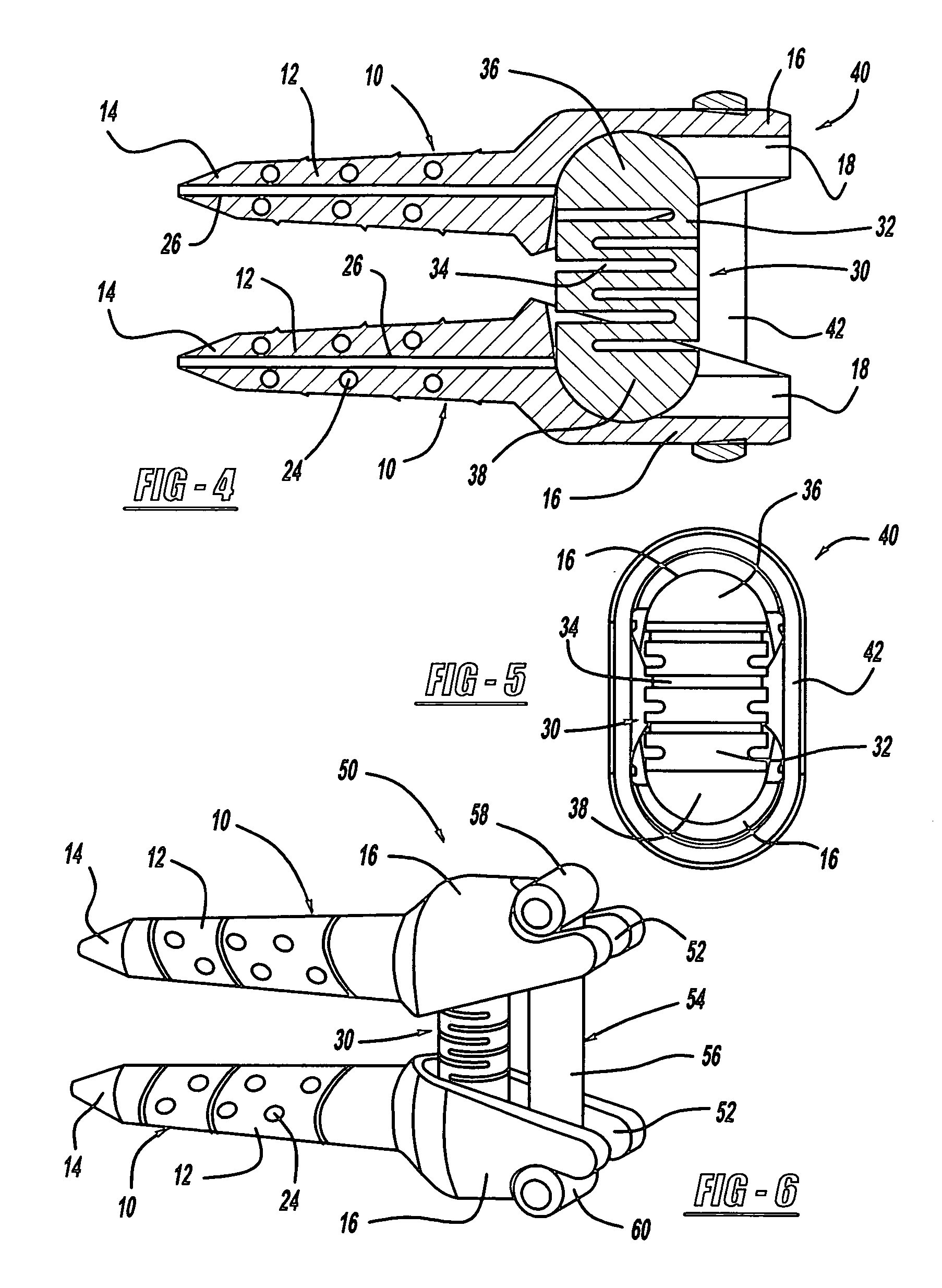 Vertebral disc annular fibrosis tensioning and lengthening device