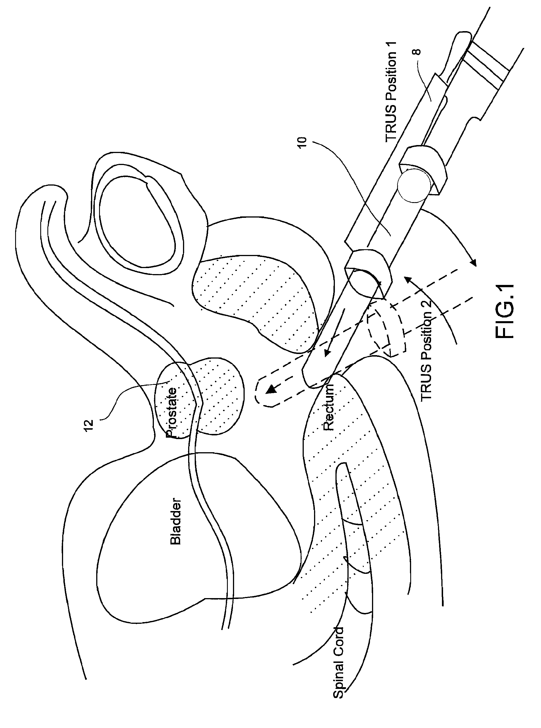 Object recognition system for medical imaging