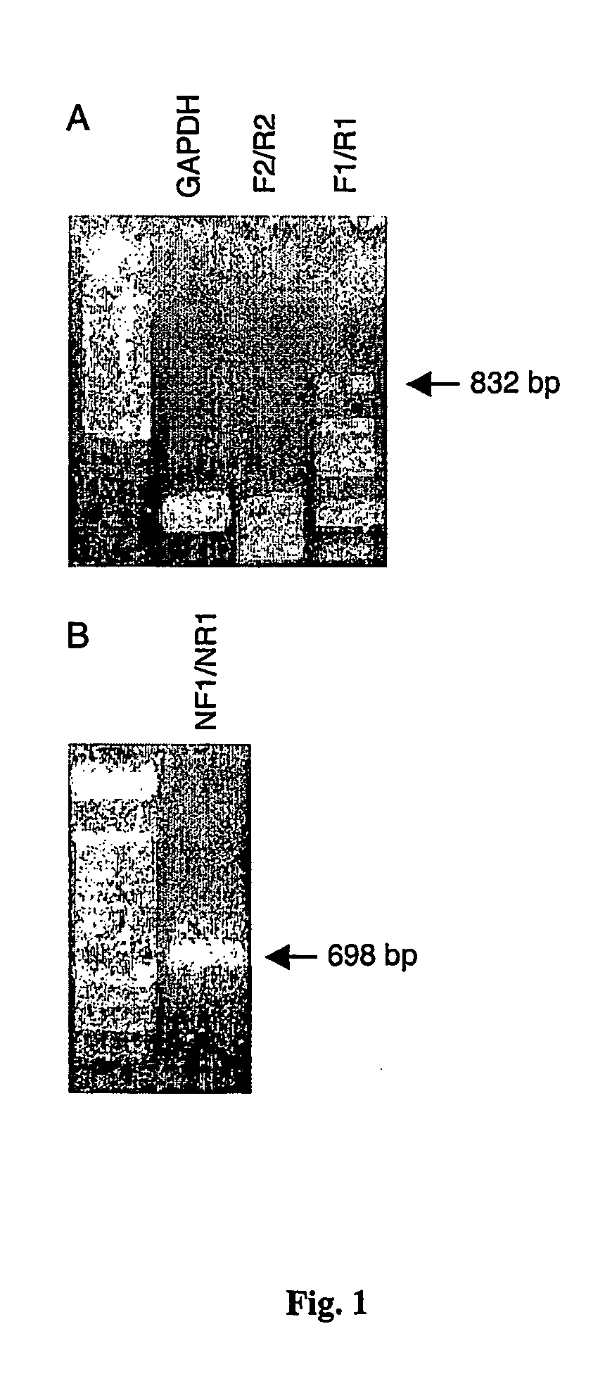 Tryptase polypeptide and uses thereof