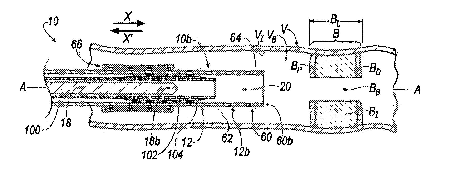 Revascularization Device for Treating an Occluded Arterial Vessel