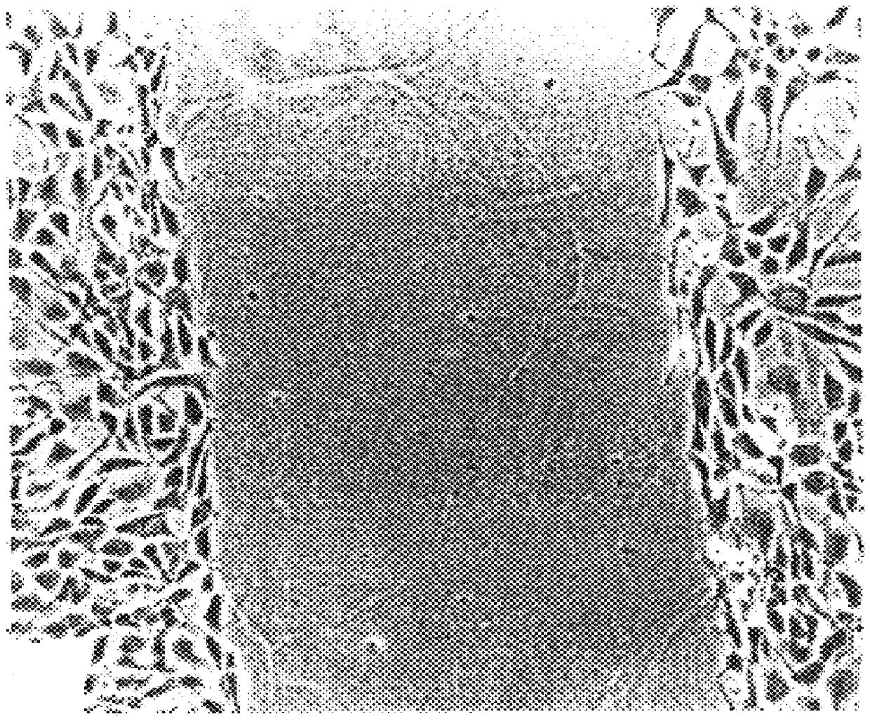 Method for inhibition of bone growth by anionic polymers