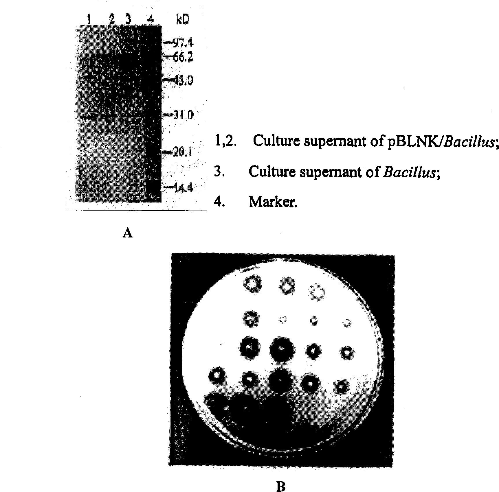 Recombined nattokinase oral preparation, preparation method and application thereof