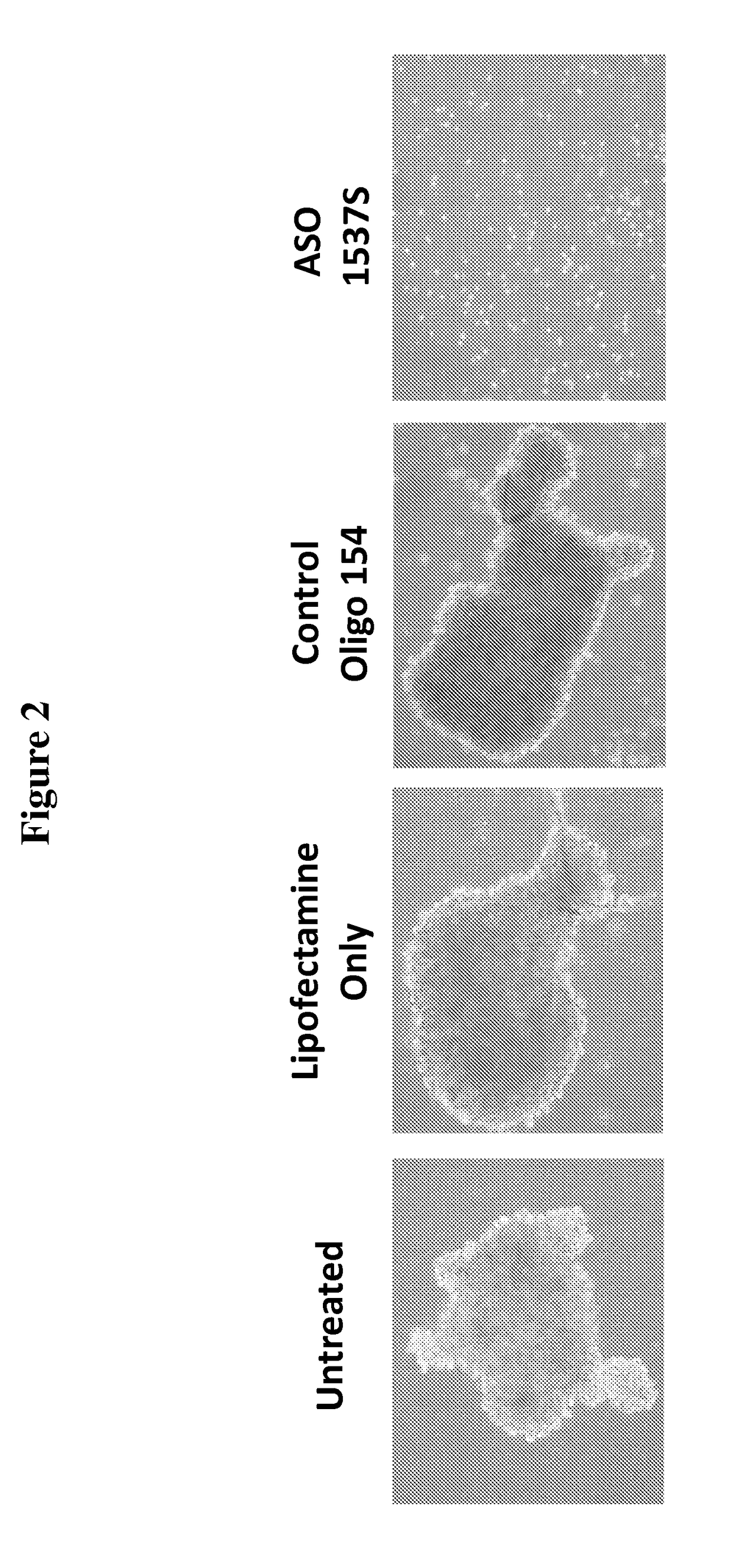 Antisense oligonucleotides for treatment of cancer stem cells