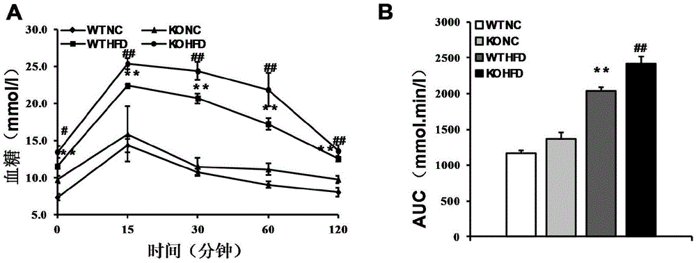 The function and application of nucleotide synthase cad gene in the treatment of fatty liver and type Ⅱ diabetes