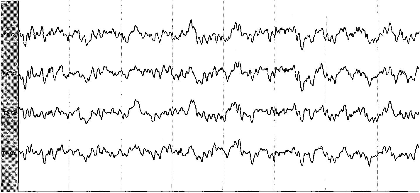 Rhesus monkey seizure model and drug screening method thereof