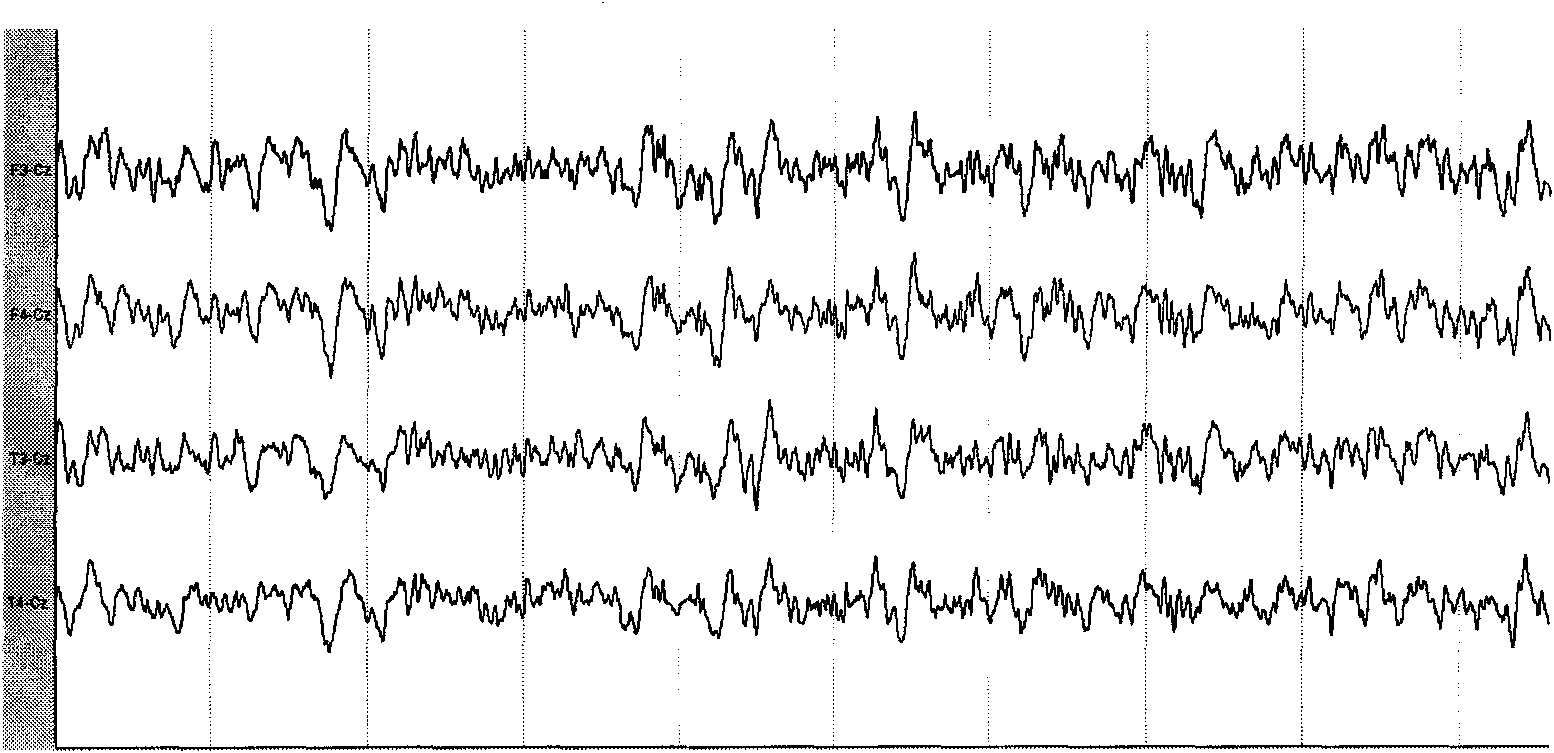 Rhesus monkey seizure model and drug screening method thereof