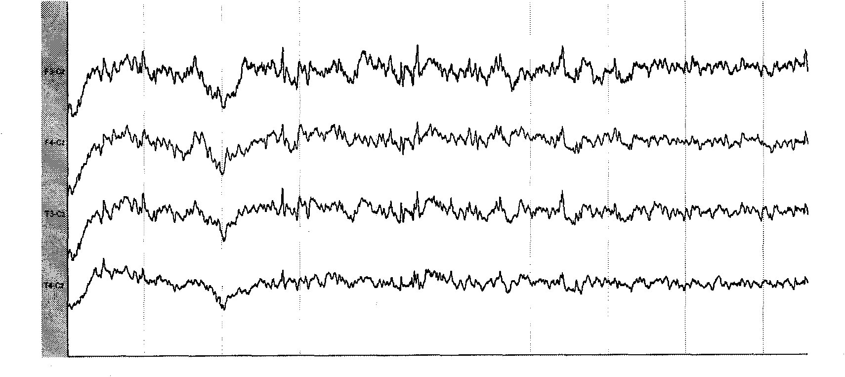 Rhesus monkey seizure model and drug screening method thereof