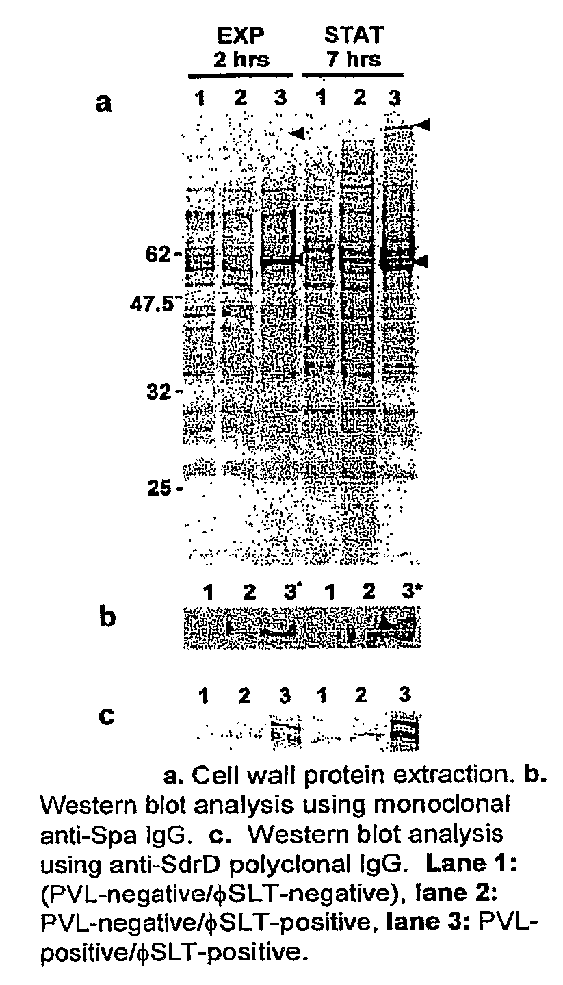 Antibodies recognizing a highly expressed putative antigen of ca-mrsa and methods of use