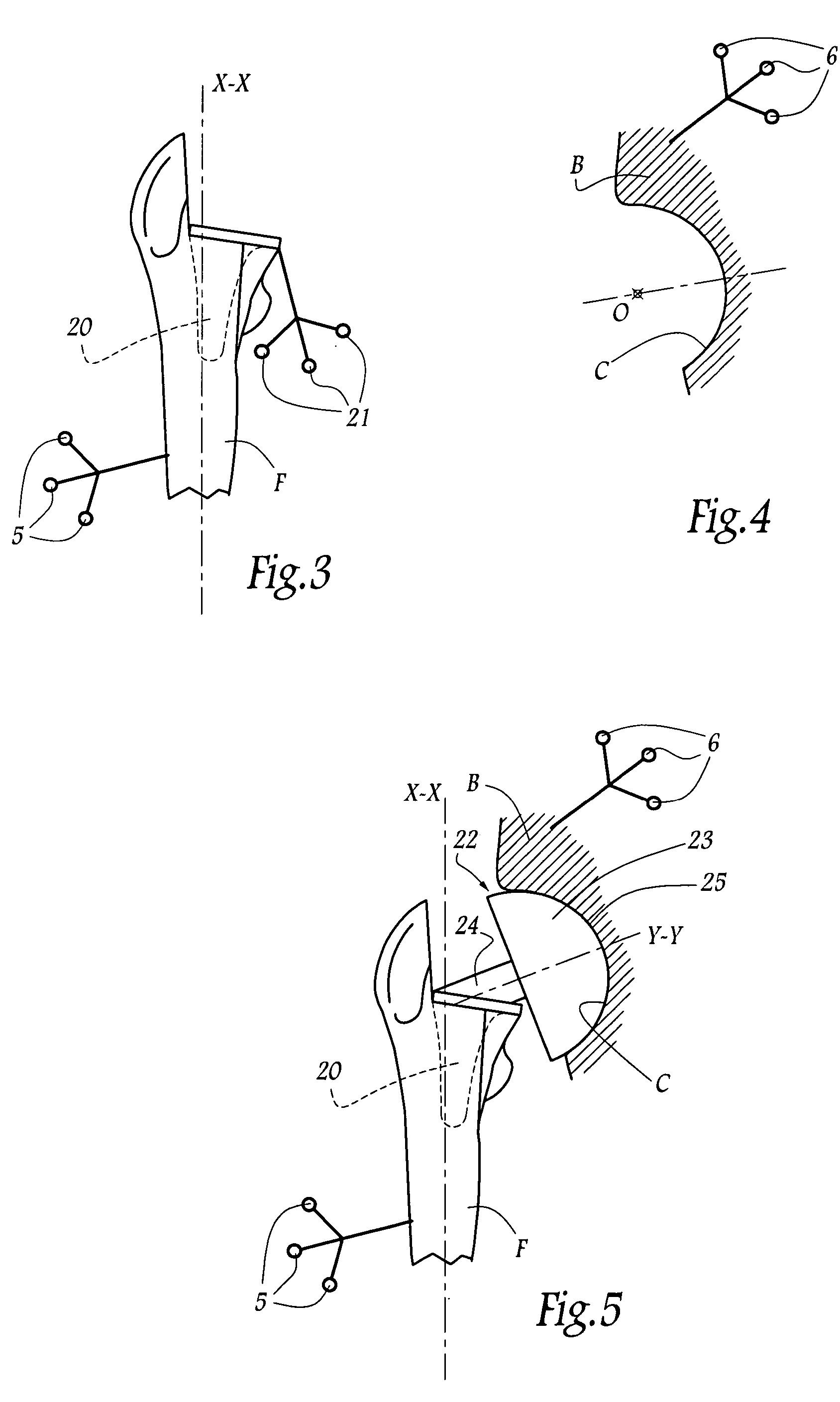 Surgical device for implanting a total hip prosthesis
