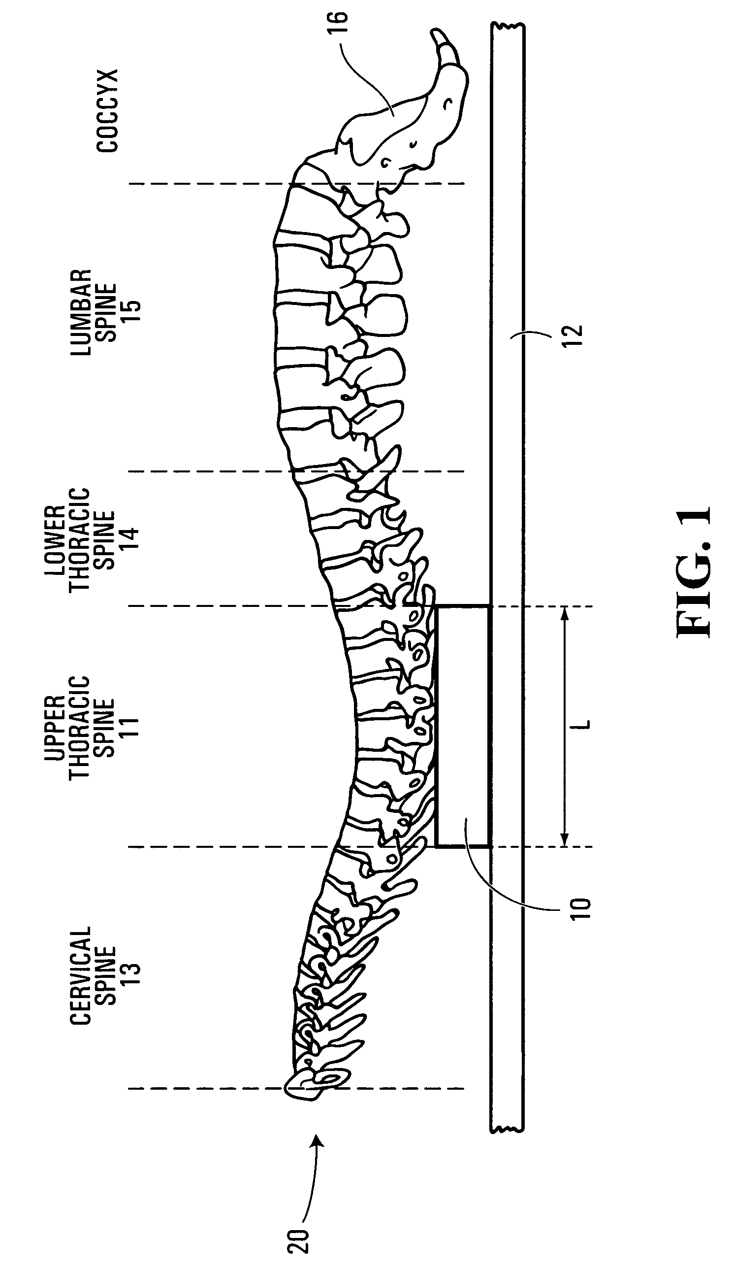 Device for correcting thoracic spine positioning