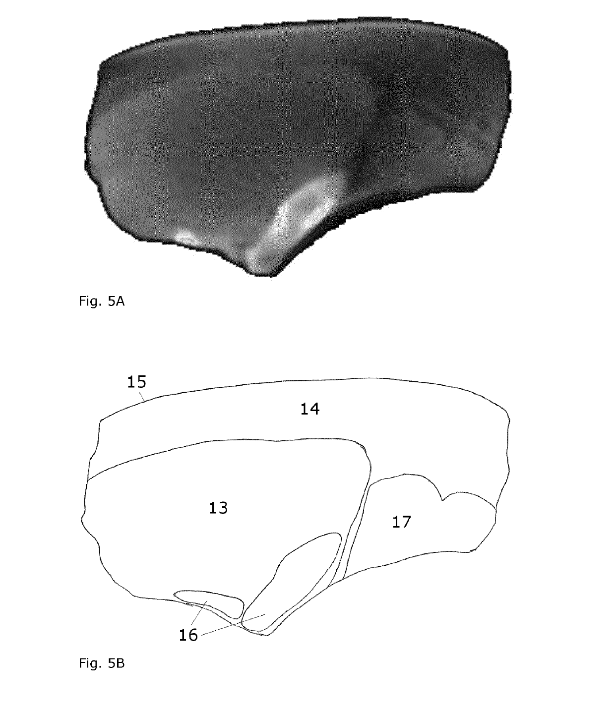 Ct-scanner with large detector pixels and/or hygienic design for continuous scanning