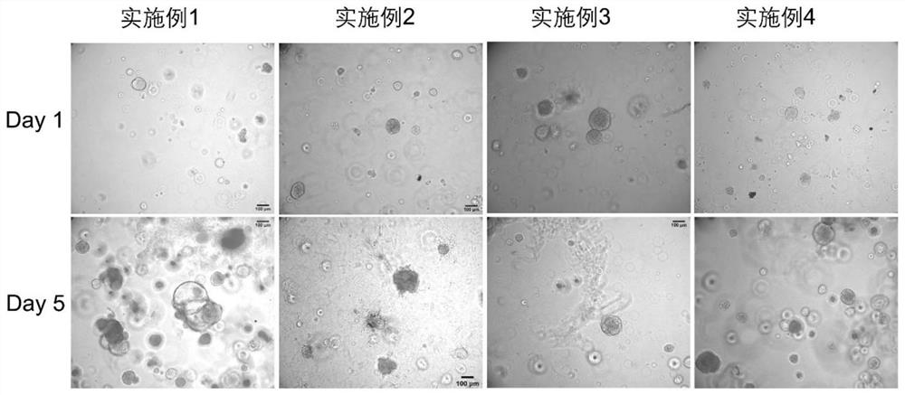 Breast cancer organoid culture solution, preparation method and culture method