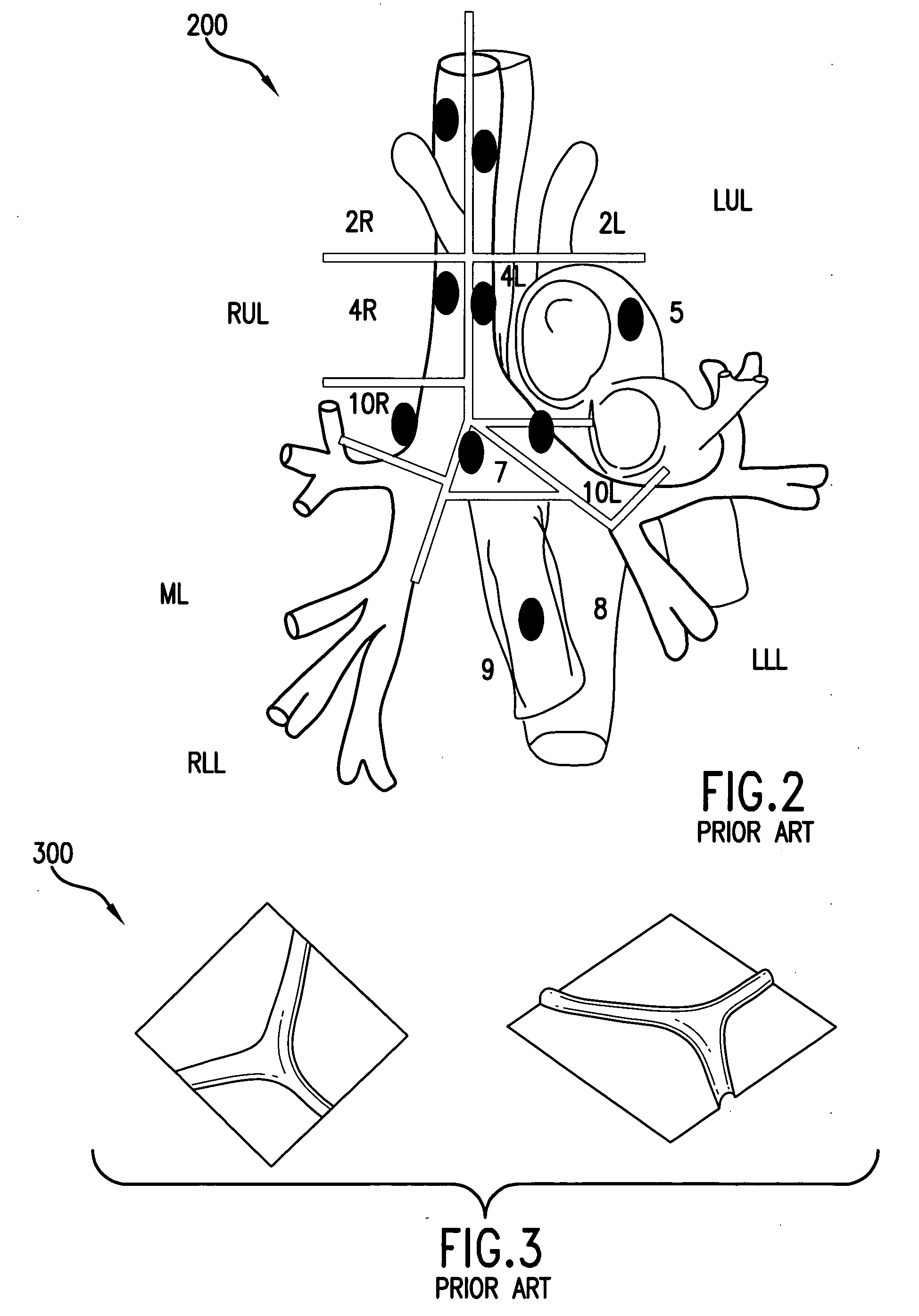 Method and system for prediction and management of material and information transport in an organism