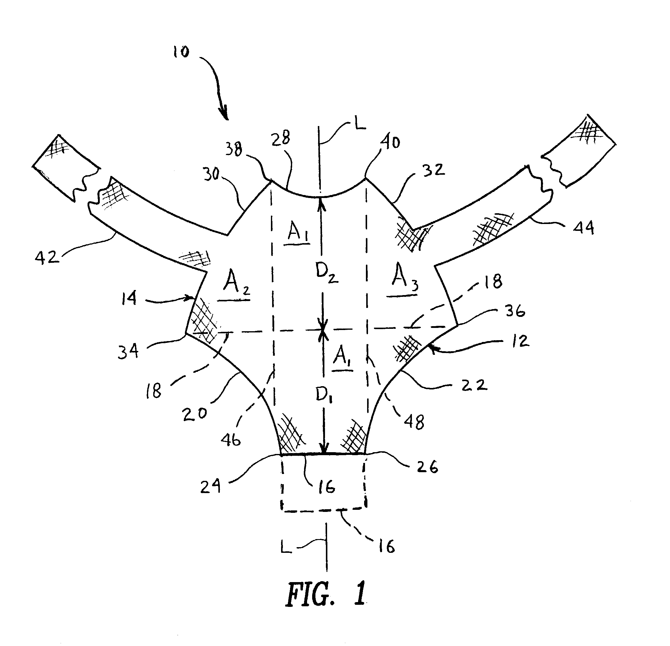 Method and apparatus for treating pelvic organ prolapses in female patients