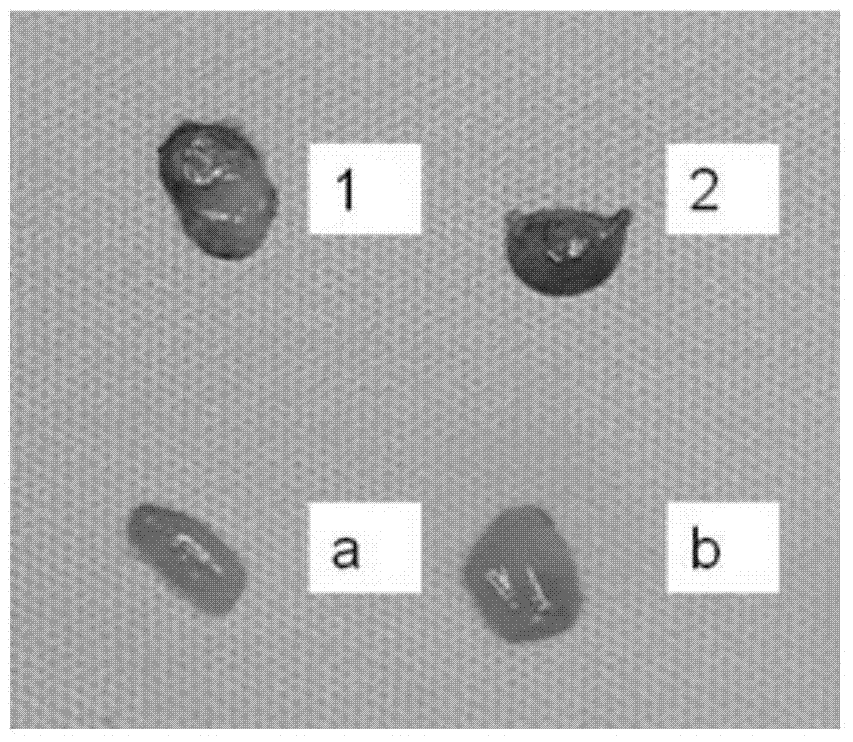 Propranolol hydrochloride smearing preparation and preparation method and application thereof