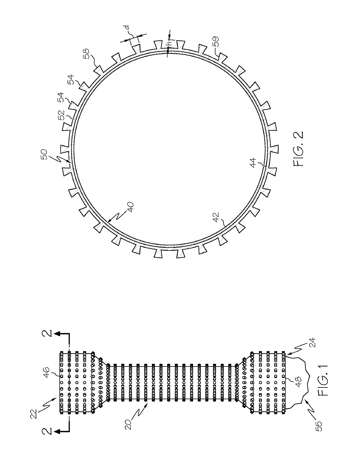 Covered endoscopic stents with adhesion elements
