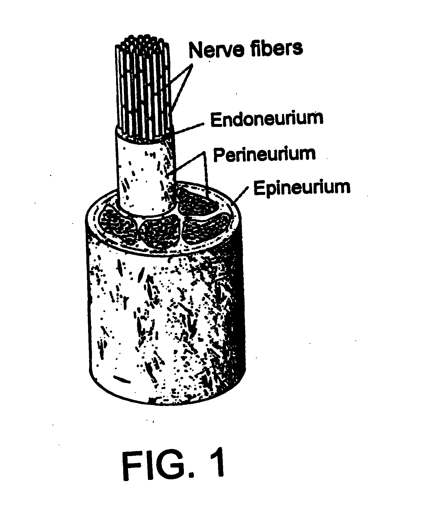 Method and system for modulating the vagus nerve (10th cranial nerve) with electrical pulses using implanted and external componants, to provide therapy for neurological and neuropsychiatric disorders