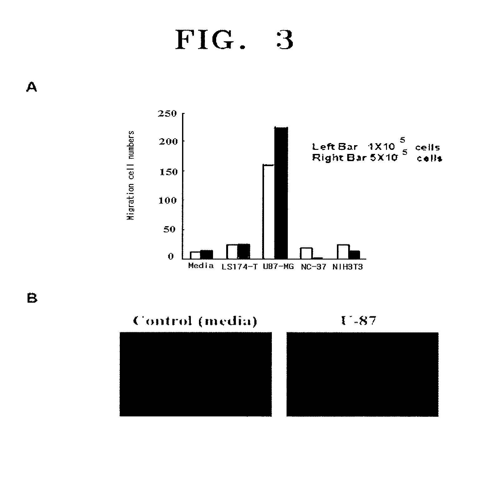 Composition for the diagnosis, prevention or treatment of diseases related to cells expressing il-8 or gro-alpha, comprising ucb-mscs