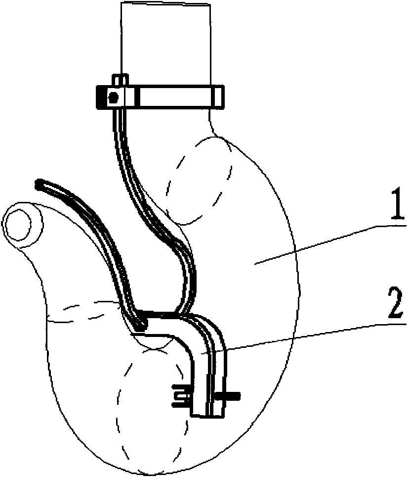 Detection device and detection method of torsional deformation of hoisting hook