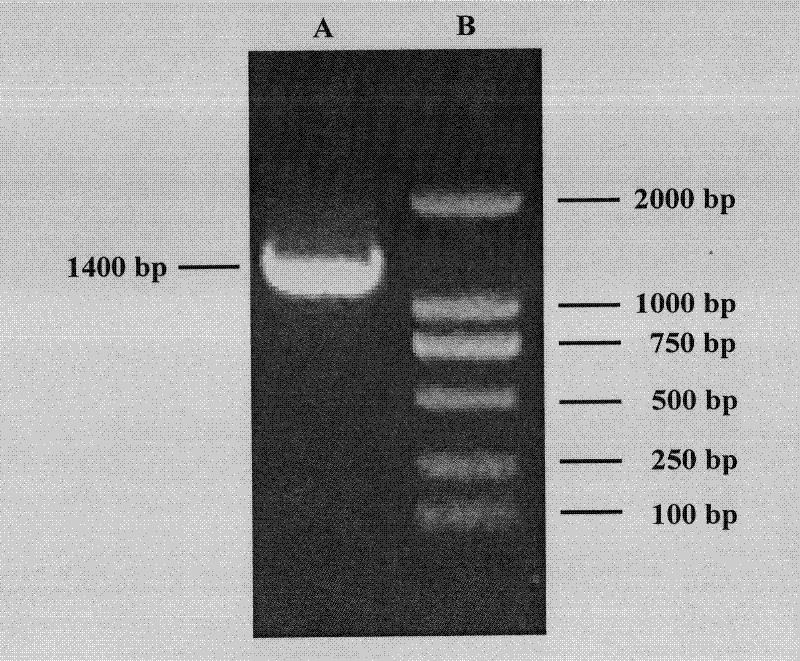 Gene GhMKK5 capable of improving bacterial resistance of transgenic crops and application thereof