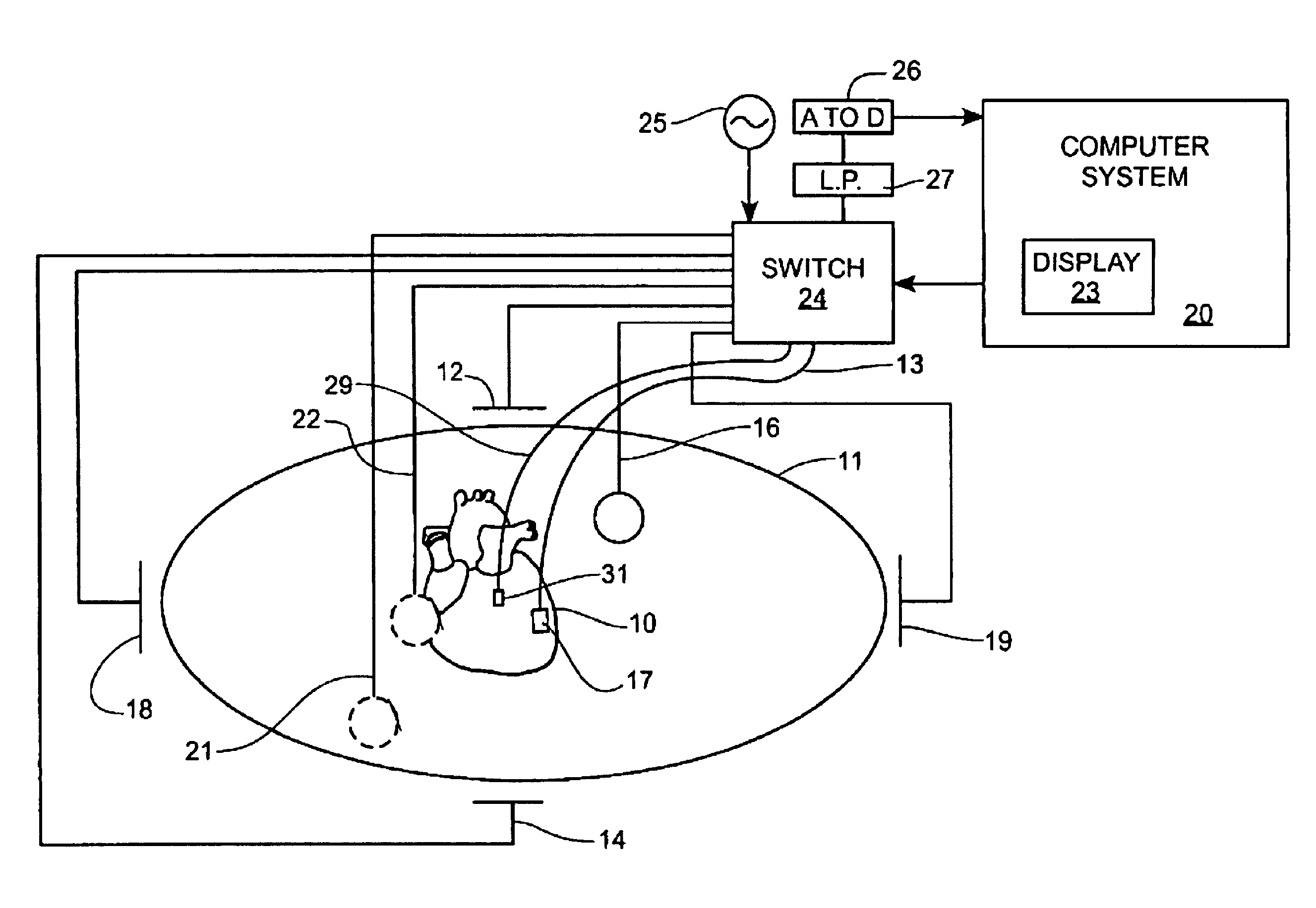 Method of scaling navigation signals to account for impedance drift in tissue