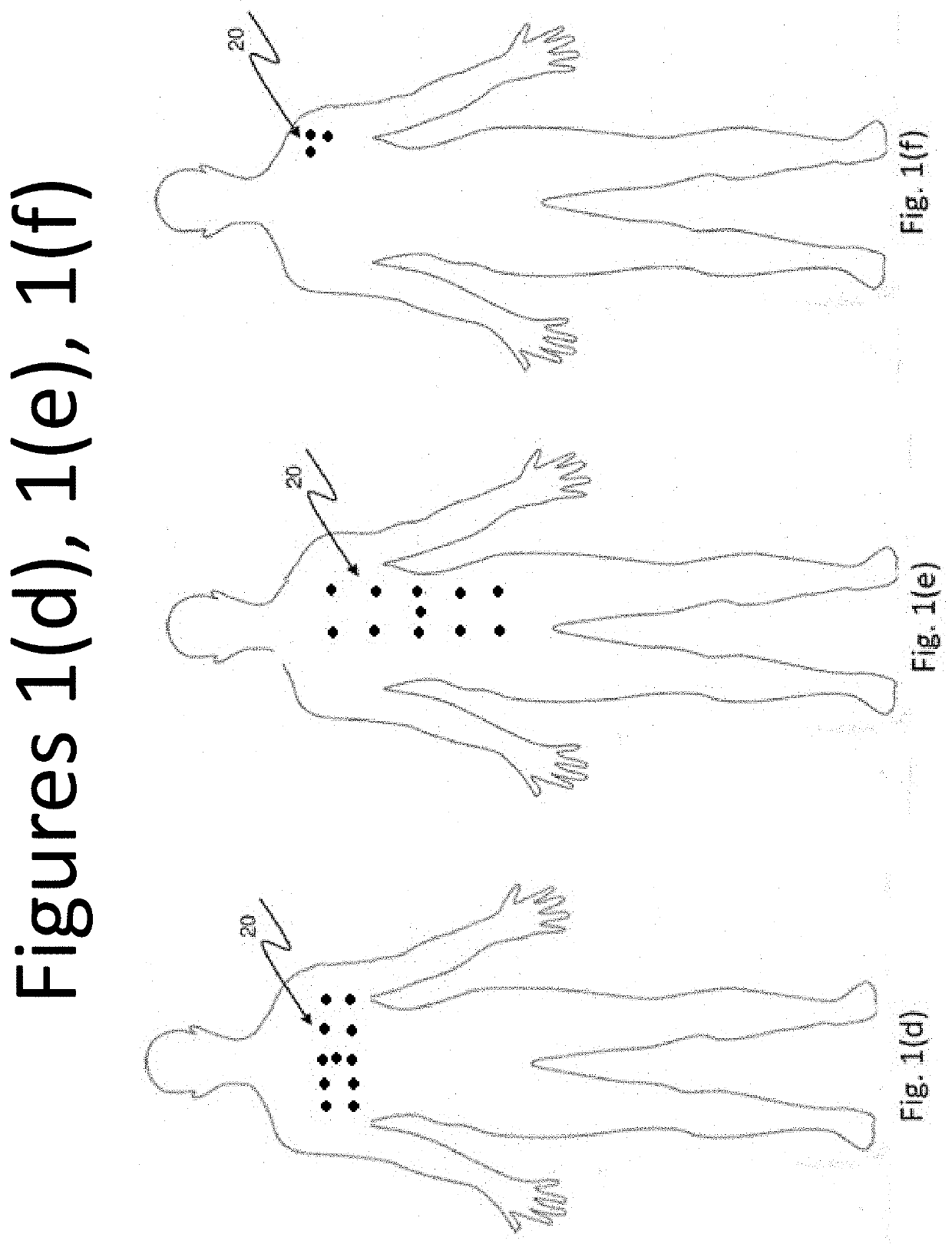 Electric biopotential signal mapping calibration, estimation, source separation, source localization, stimulation, and neutralization.