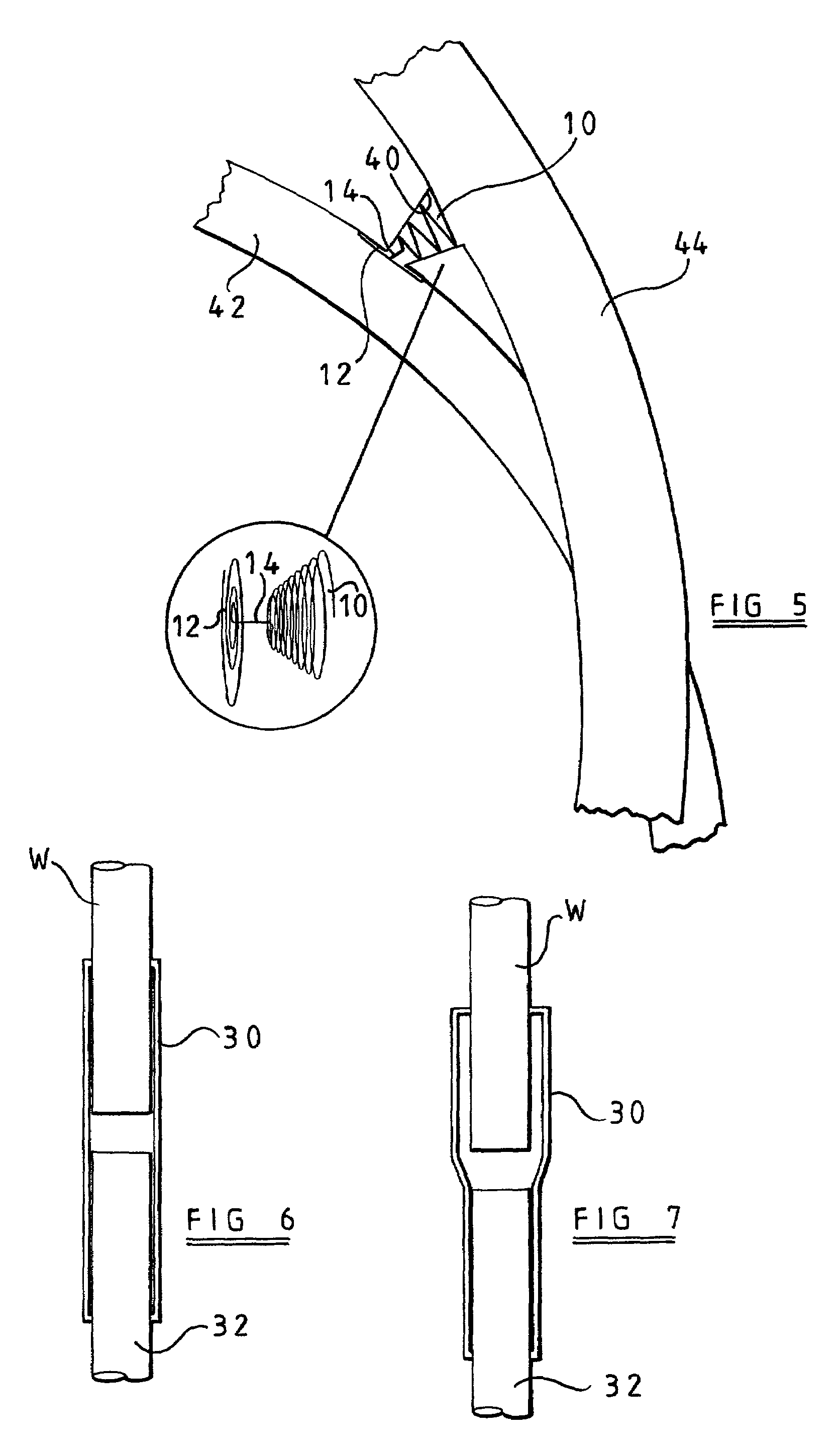 Surgical implants and delivery systems therefor
