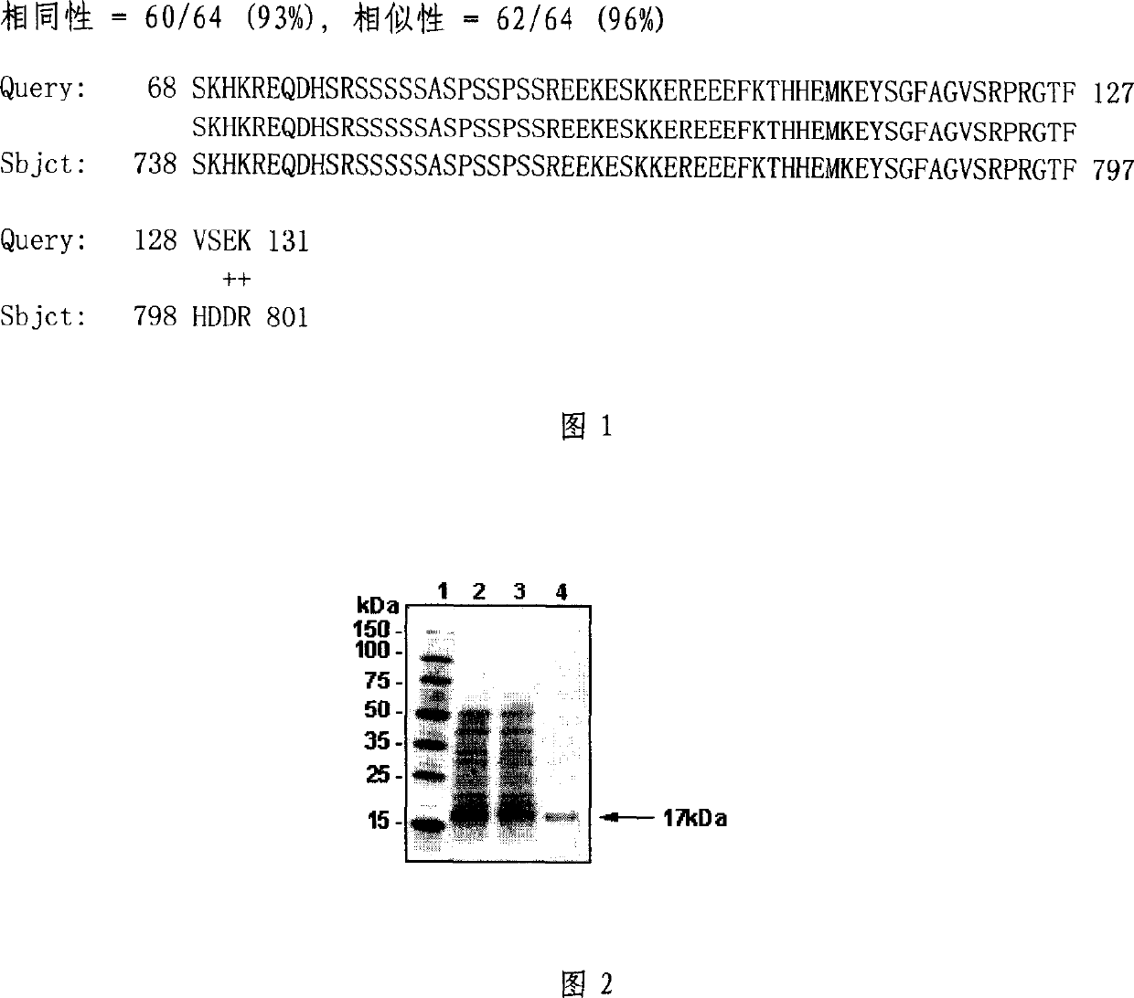 Polypeptide-human transferring factor concerned with anti-withering protein-16.94 and polynucleotide for encoding it