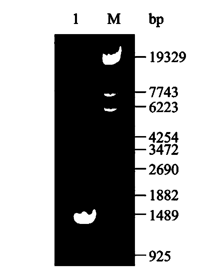 Succinic acid genetic engineering bacterium and method for fermenting and producing succinic acid