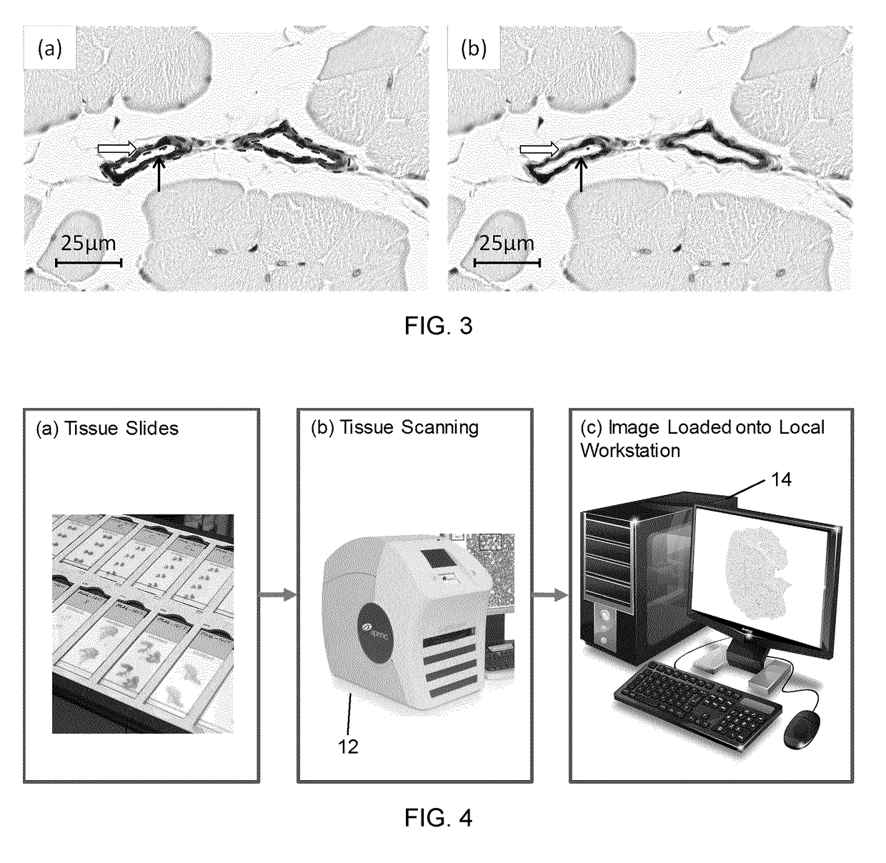 Automated segmentation of histological sections for vasculature quantification