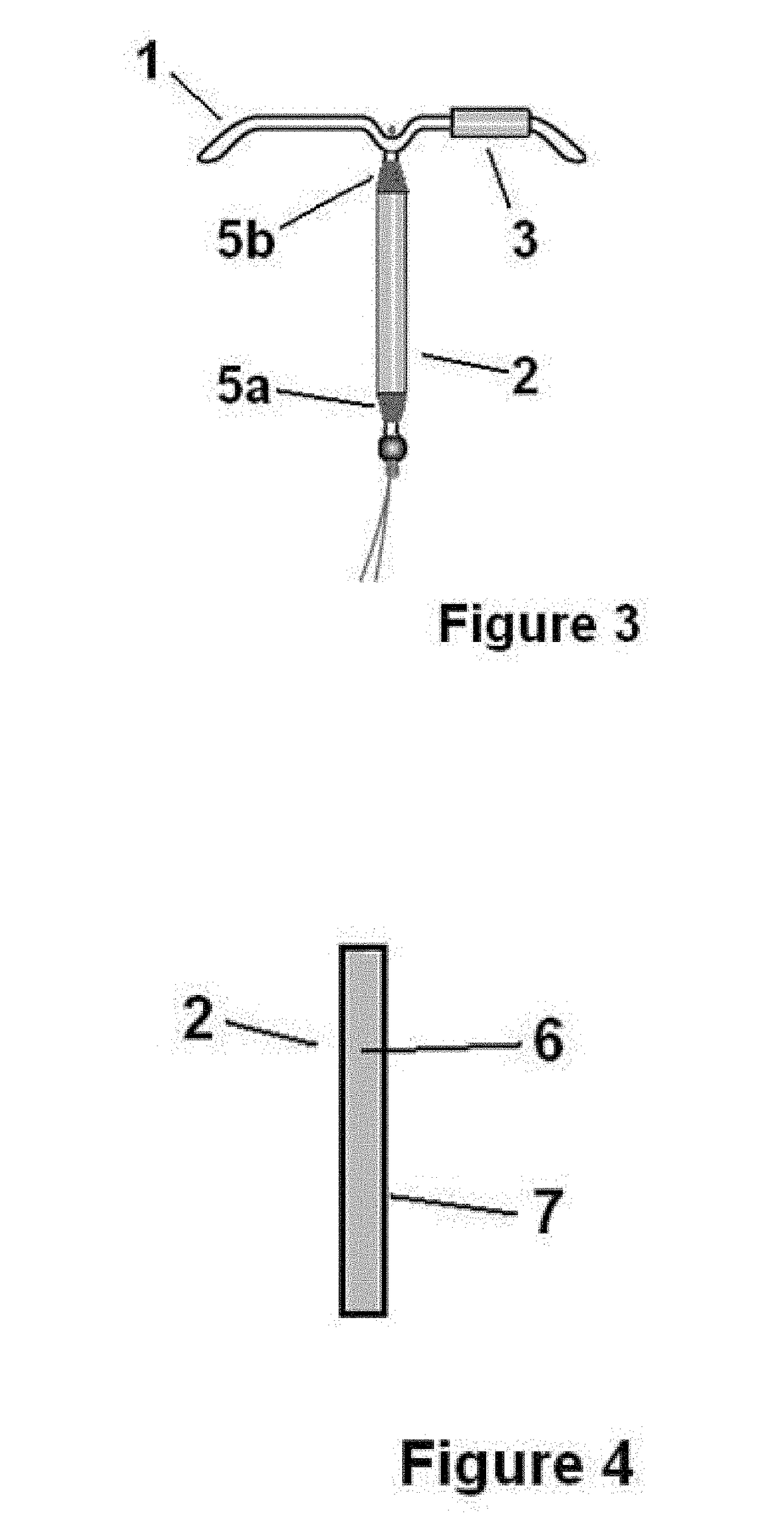 Method of contraception