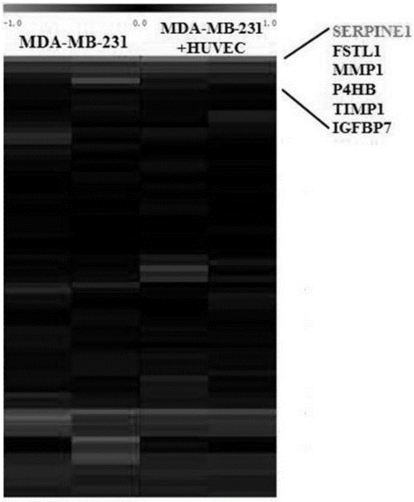 Method for detecting influence of triple negative breast cancer cell on endothelial cell secretion function in epithelial-mesenchymal transition process