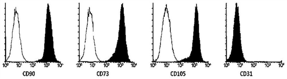 Stem cell composite preparation and preparation method thereof