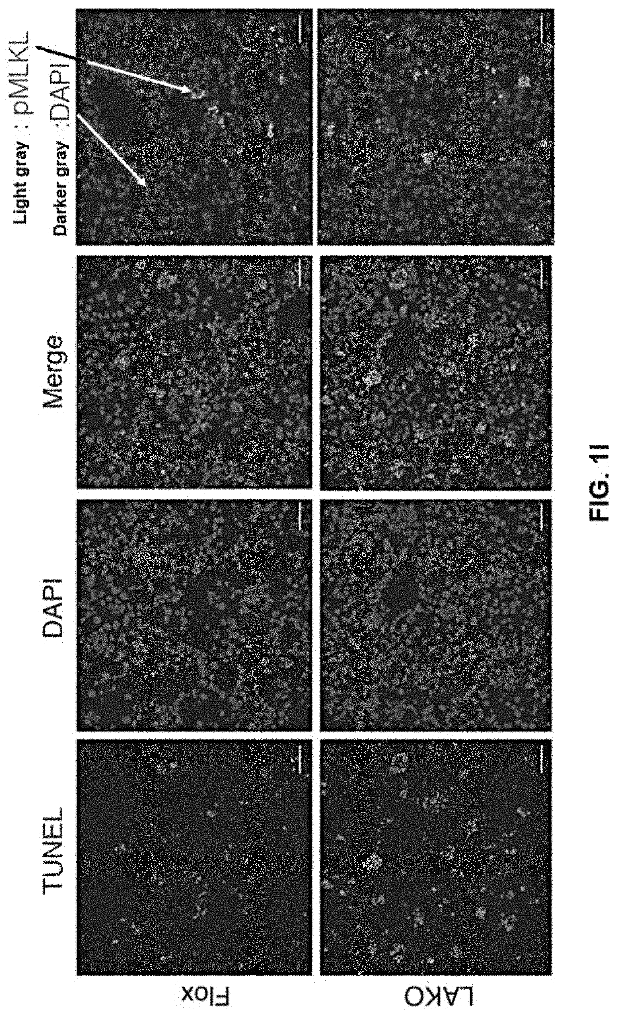 Ampk/caspase-6 axis controls liver damage in nonalcoholic steatohepatitis