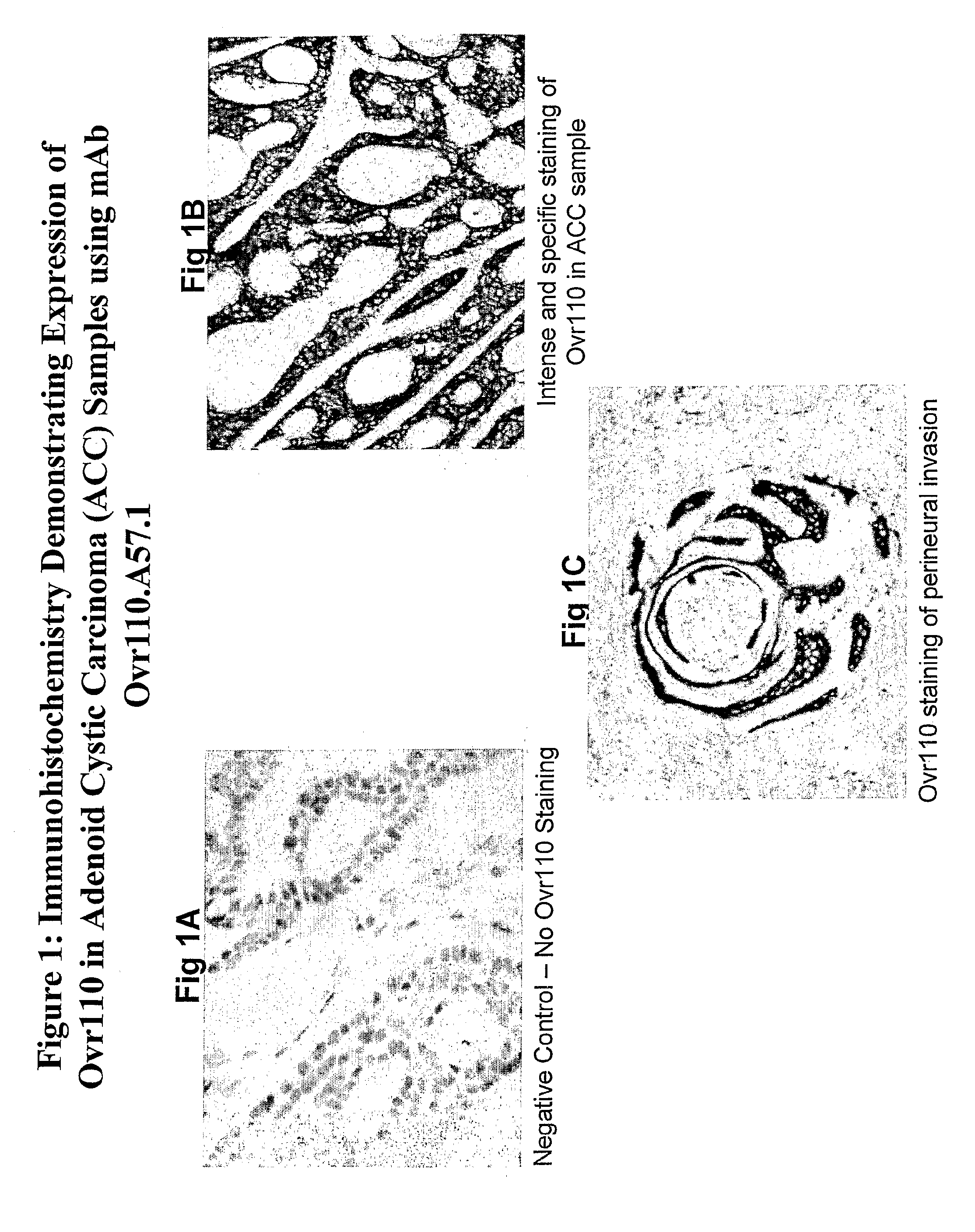 Ovr 110 Antibody Compositions and Methods of Use