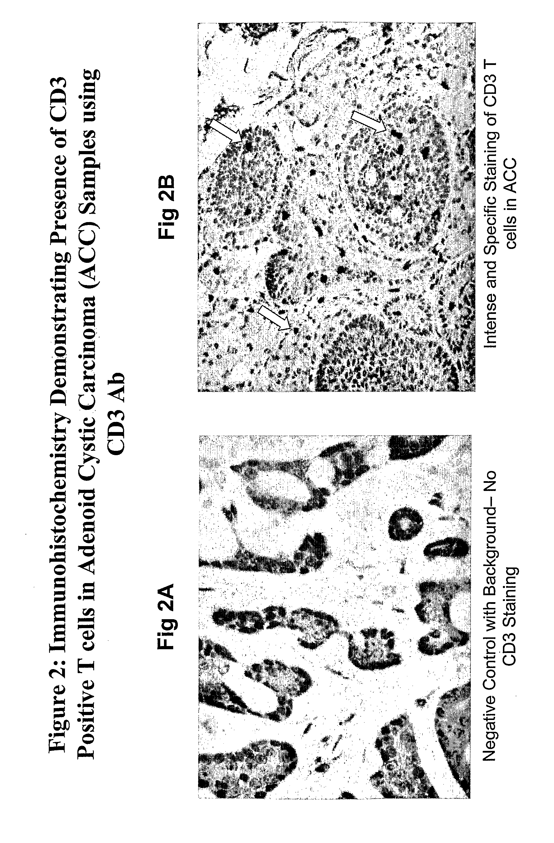 Ovr 110 Antibody Compositions and Methods of Use