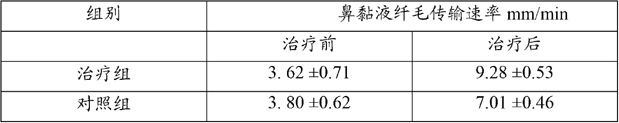 Traditional Chinese medicine composition for treating acute sinusitis and preparation method thereof