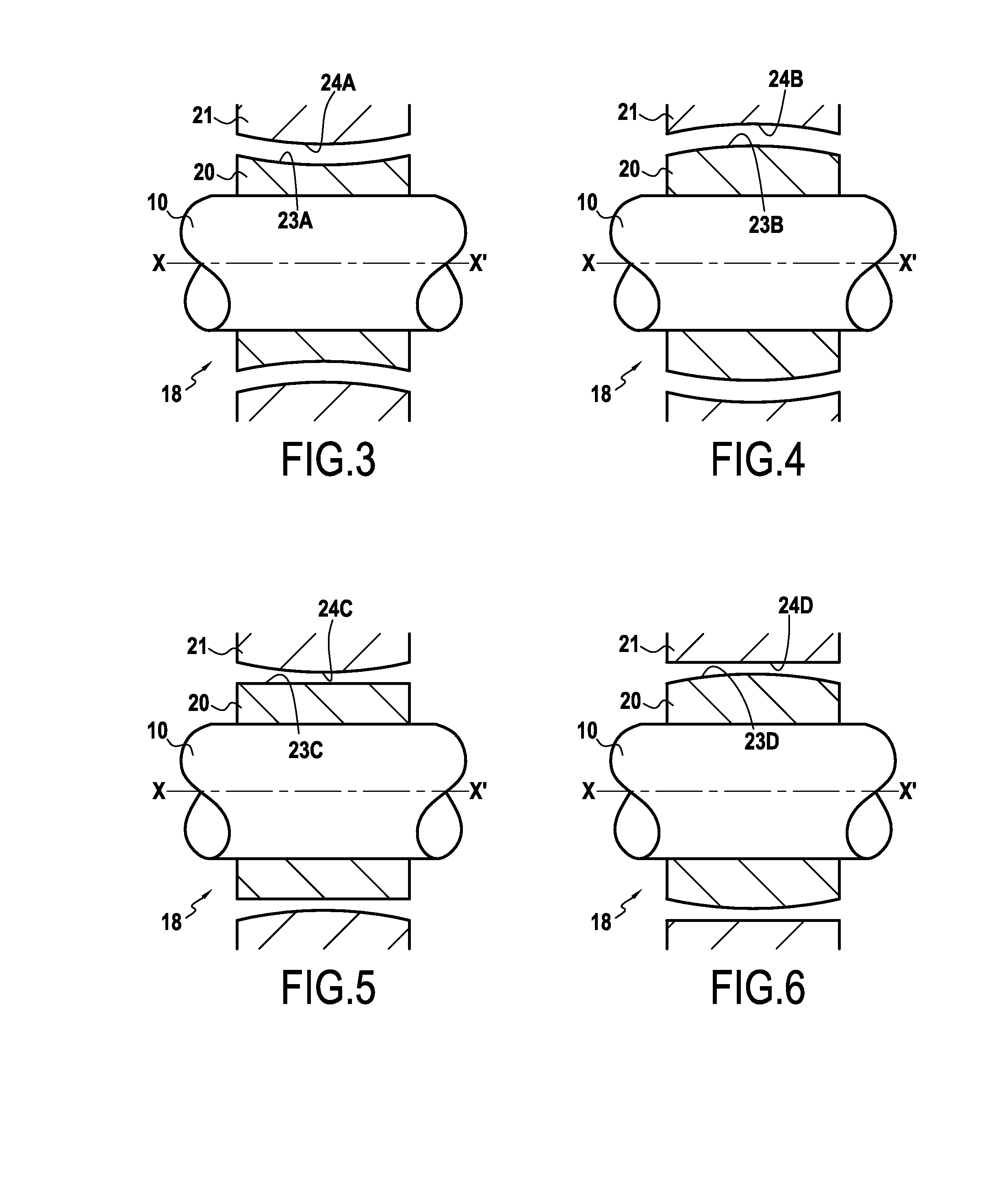 Auxiliary bearing for magnetically suspended rotor system