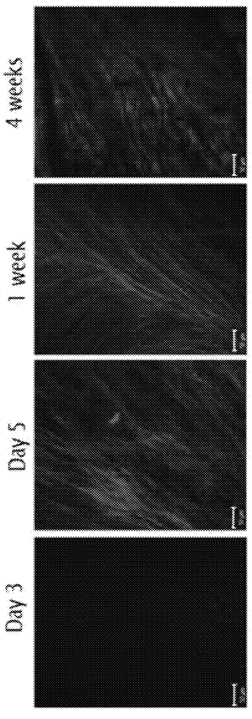 Antibodies targeted against LOXL-2 for the treatment of collagen-associated pathologies