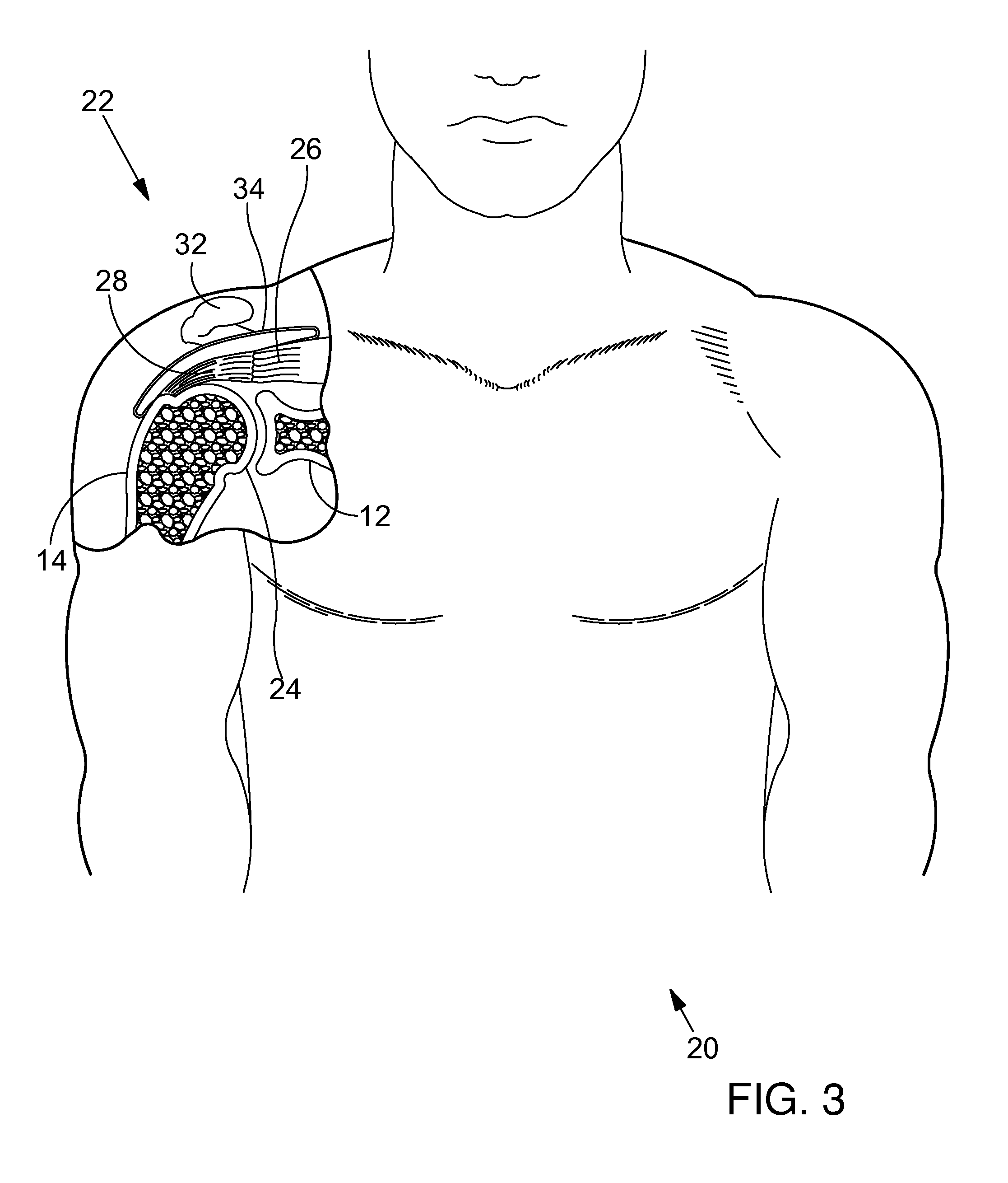 Methods and apparatus for fixing sheet-like materials to a target tissue