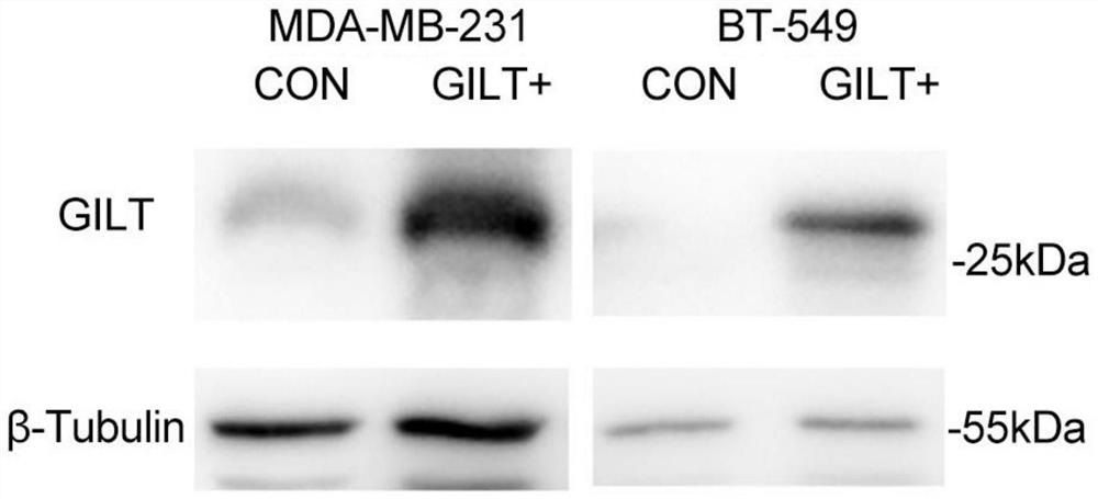Application of gamma interferon-induced lysosomal sulfydryl reductase GILT in enhancing anti-tumor immune response