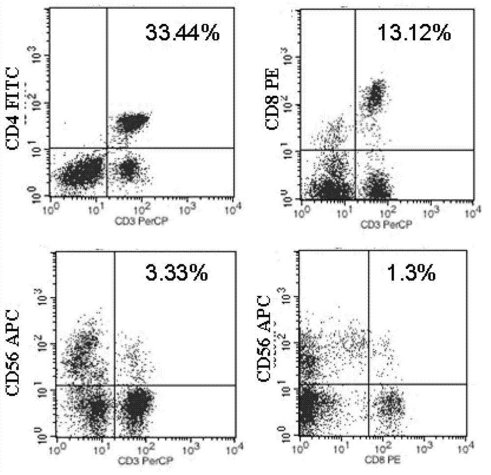 Application of CIK (cytokine induced killer) cell loaded by anti-CD3/anti-CD133 bispecific antibody